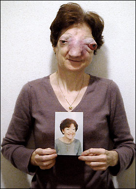 as she was and after the effects of cancer